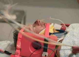 RAF Pilot Recalls Terrifying Crash at Elgin Airfield: Horror Injuries and Survival Story news-26112024-231633